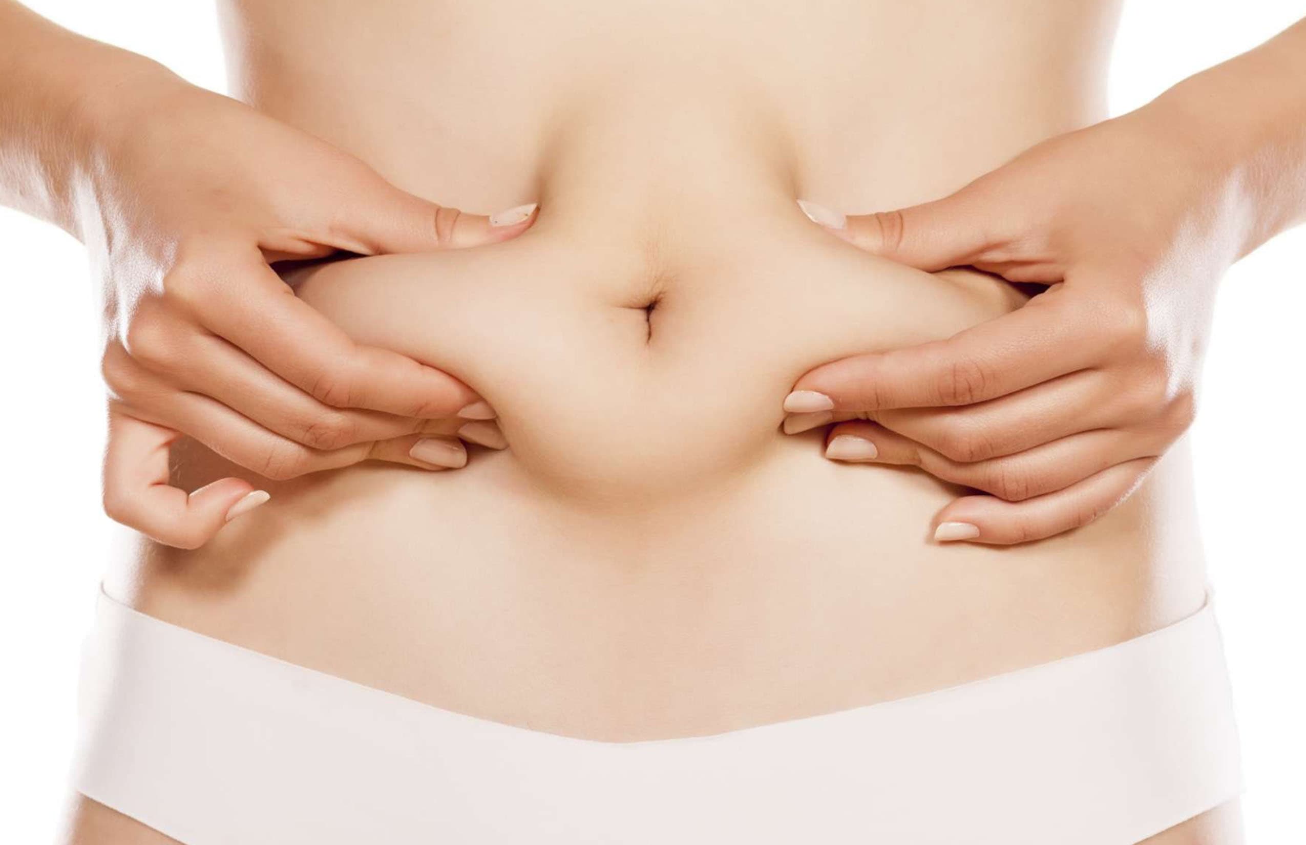 Abdominoplastía en Chihuahua
